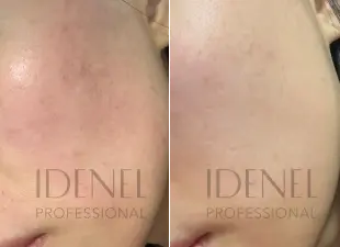 Fine lines & texture